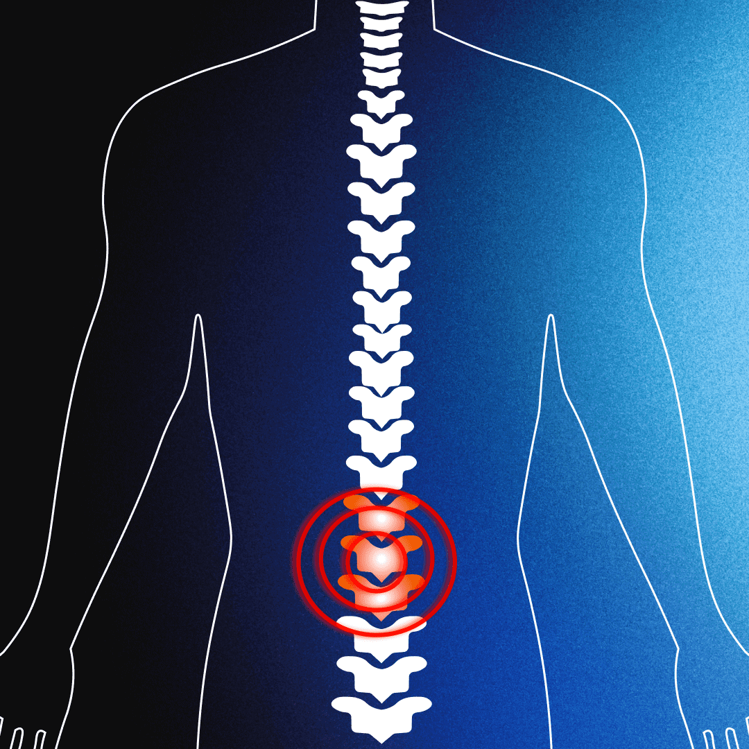 A spine design