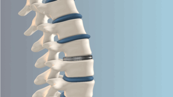 Spine
