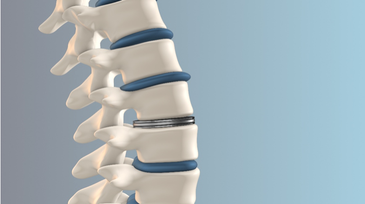 Spine