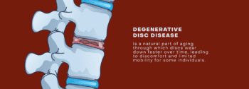 Degenerative Disc Disease | National Spine Health Foundation