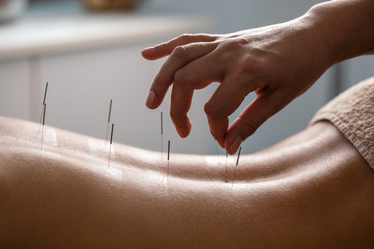 Best Acupuncture London