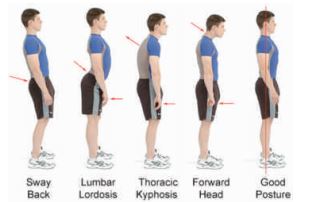 Provide the latest products Poor Posture: The Main Culprit Behind