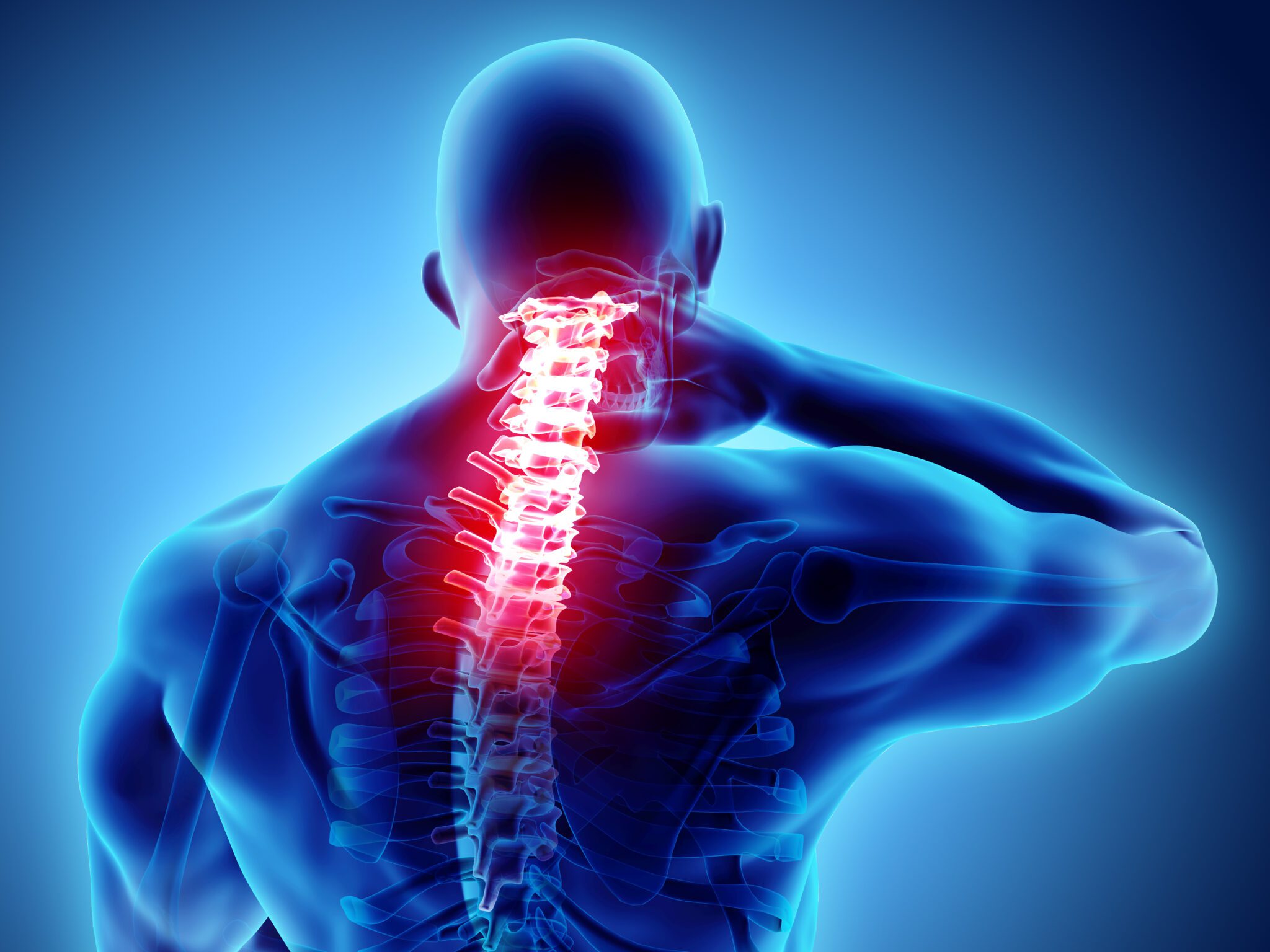 Spinal Arthritis Symptoms Scaled 